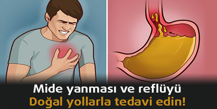 MİDE YANMASI VE REFLÜYÜ DOĞAL YOLLARLA TEDAVİ EDİN!...