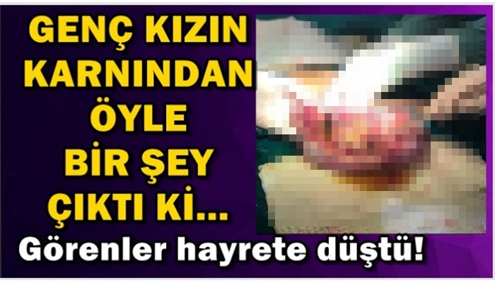 GENÇ KIZIN KARININ ÖYLE BİR ŞEY ÇIKTI Kİ GÖRENLER ŞOKE OLDU