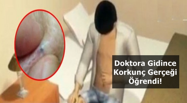 KAŞINIYOR DİYE DOKTORA GİTTİ KORKUNÇ GERÇEĞİ ÖĞRENDİ ‘