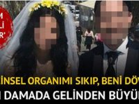 Karım beni dövüyor’ diyen damada büyük şok!