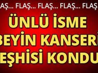 ÜNLÜ İSME BEYİN KANSERİ TEŞHİSİ KONDU SEVENLERİ ŞOKE OLDU