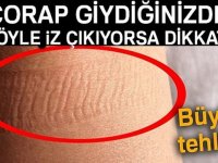 Kalbinizin Doğru Çalışmadığını Gösteren 7 İşaret