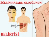 Karaciğerin Hasar Gördüğüne Dair Vücutta Ortaya Çıkan 12 Belirti