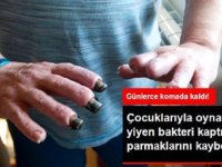 Çocukları ile Bahçede Oynarken Et Yiyen Bakteri Kapan Adamın Parmakları Kaybetti