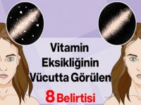 Vitamin Eksikliğinin Vücutta Görülen 8 Belirtisi
