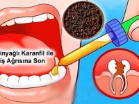 Diş Ağrıs-ına Zeytinyağlı Kar-anfil ile Son