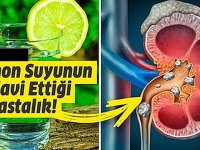 Lim-on Suyu Neye İyi Gelir? Limon Suyu İle Tedavi Edebile-ceğiniz 8 Sağlık Pro-blemi