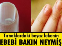 Tırnaklardaki beyaz lekeler neyin habercisi
