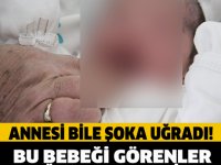 YENİ DOĞAN BU BEBEĞİ GÖRENLER ESTAĞFURULLAH ÇEKİYOR!