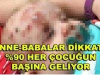 BEBEĞİN SURATINDA YARALAR ÇIKTI ANNE NEDENİNİ ÖĞRENİNCE KAHROLDU