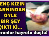 GENÇ KIZIN KARININ ÖYLE BİR ŞEY ÇIKTI Kİ GÖRENLER ŞOKE OLDU