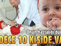 ONUN HASTALIĞI DÜNYADA SADECE 10 KİŞİDE VAR! ŞOKE EDEN HASTALIK